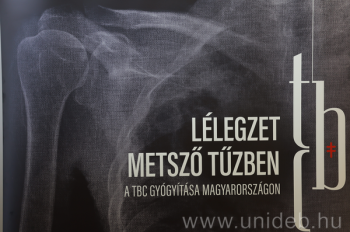 Képeken a tuberkulózis története